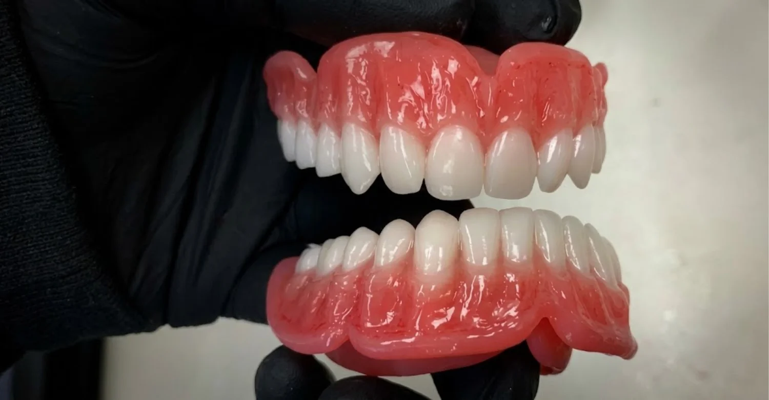 Fixed Prosthesis vs 3D Printed Overdenture 2